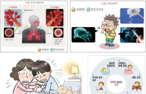 (신농씨 칼럼)소아의 천식