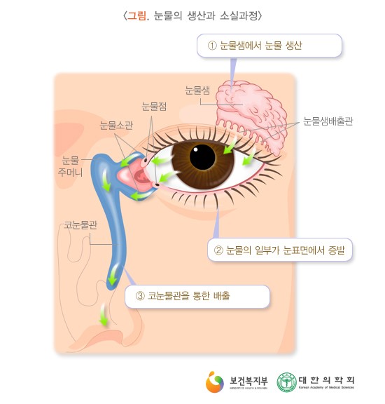 안구건조증