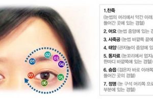 안구건조증(건성안)