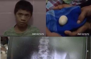 20개 알 낳았다고 주장?? 인도네시아 14세 소년