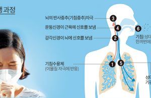 만성 해수(오래가는 기침)