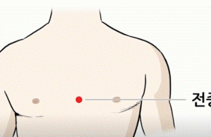 (신농씨한의원) 스트레스와 화병