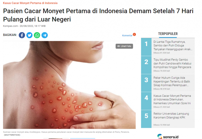 자카르타에서 두창 환자 13명으로 늘어… “비말 감염”