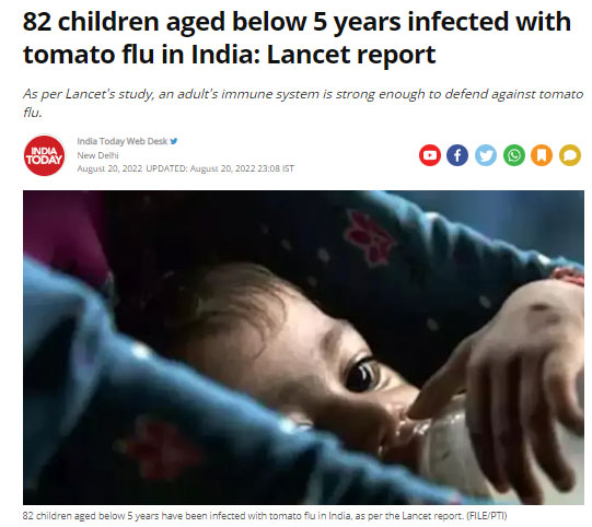 '인도에서 토마토 독감에 감염된 5세 미만 어린이 82명: Lancet 보고서' /인디아 투데이 갈무리