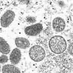 베트남, 원숭이두창 감염 첫 확인…방역 강화