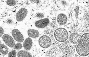 베트남, 원숭이두창 감염 첫 확인…방역 강화