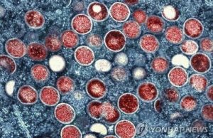 자카르타서 엠폭스 환자 보름새 12명 나와