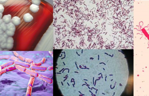 바실러스 세레우스(Bacillus cereus) 균