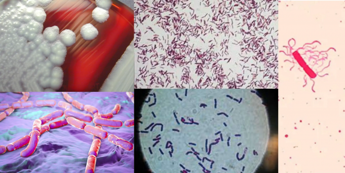 바실러스 세레우스(Bacillus cereus) 균