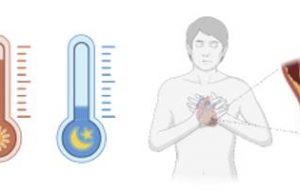 “심근경색 피크 바뀌었다…”환절기에 발생률 최고”