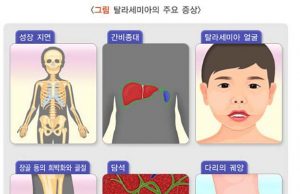 인도네시아에서 발생하는 지중해성 빈혈의 관심과 대책
