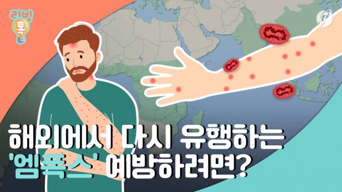 다시 유행하는 엠폭스…예방하려면?