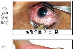담뱃갑 새 건강경고 ‘폐암으로 가는 길’ 문구·그림 적용