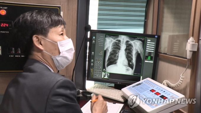 한국 ‘결핵 발생률’이 세계 최고?…인도네시아는