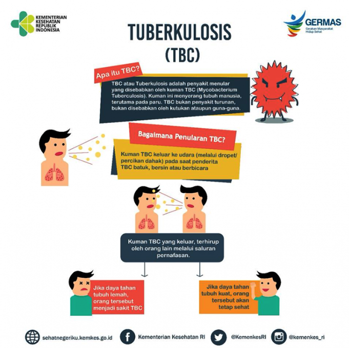 북부 자카르타, 대규모 검진 결핵 환자 5,942명 발견