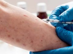 인도네시아, 호주 관광객 홍역 확진에 보건당국 비상