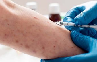 인도네시아, 호주 관광객 홍역 확진에 보건당국 비상