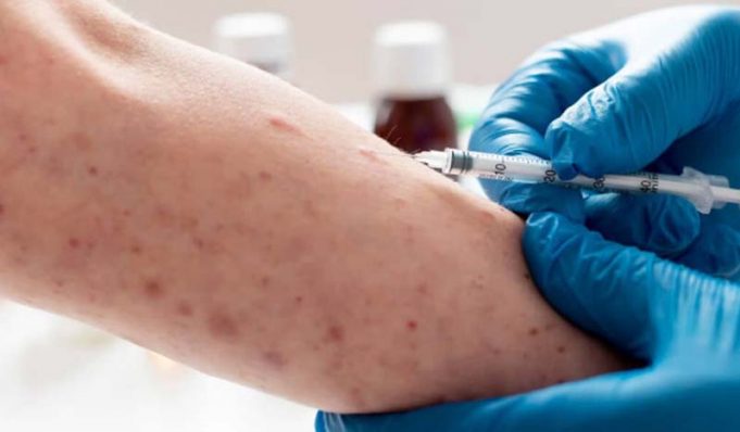 인도네시아, 호주 관광객 홍역 확진에 보건당국 비상