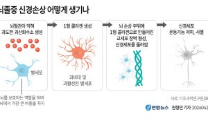 뇌졸중 신경손상 어떻게 생기나