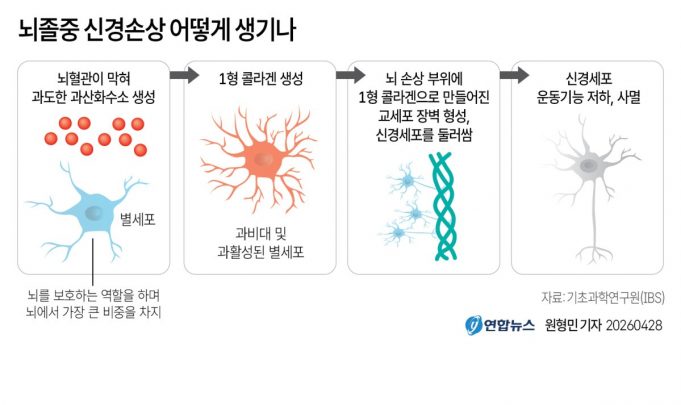 뇌졸중 신경손상 어떻게 생기나