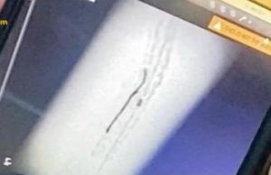 인도네시아 보건부, 환자 심장 내 의료용 와이어 잔류 의혹에 조사단 급파… “과실 확인 시 엄중 문책”